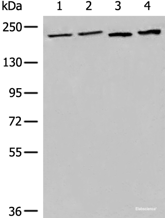 Western blot analysis of 293T cell Human metastatic malignant melanoma tissue lysates  using EEA1 Polyclonal Antibody at dilution of 1:700