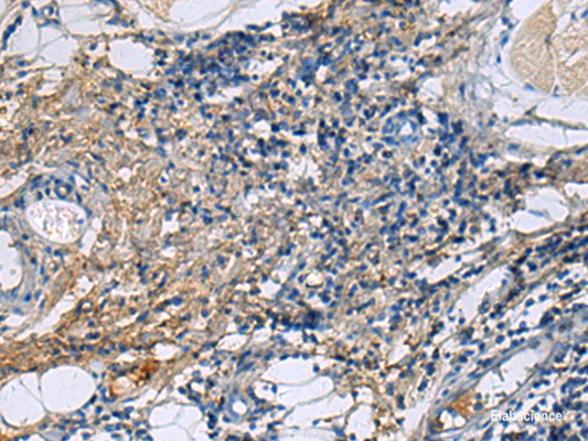 Immunohistochemistry of paraffin-embedded Human tonsil tissue  using PROC Polyclonal Antibody at dilution of 1:100(×200)