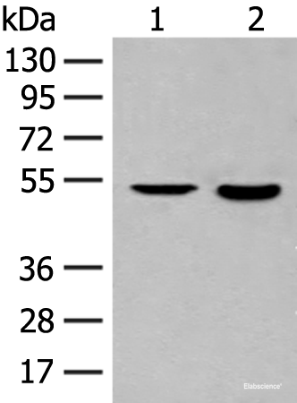 Western blot analysis of Jurkat cell and Human fetal brain tissue lysates  using IL7R Polyclonal Antibody at dilution of 1:800