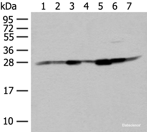 Western blot analysis of Hela HT-29 and HEPG2 cell Human liver tissue Human fetal liver tissue Mouse liver tissue and Human fetal brain tissue lysates  using NIPSNAP2 Polyclonal Antibody at dilution of 1:400