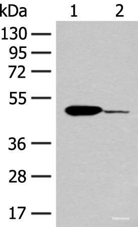 Western blot analysis of Mouse heart tissue and K562 cell lysates  using ACOD1 Polyclonal Antibody at dilution of 1:400