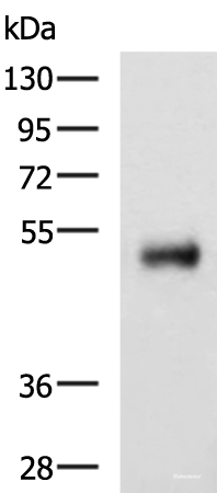 Western blot analysis of Human colorectal cancer tissue lysate  using METTL17 Polyclonal Antibody at dilution of 1:800