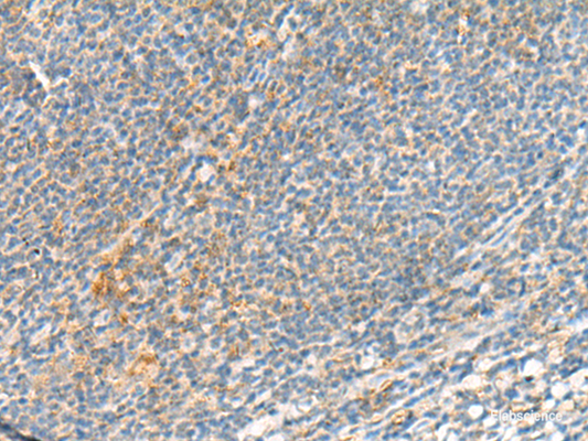 Immunohistochemistry of paraffin-embedded Human tonsil tissue  using TSHB Polyclonal Antibody at dilution of 1:95(×200)