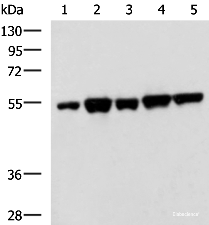 Western blot analysis of PC3 K562 HepG2 Hela A172 cell lysates  using FKBP5 Polyclonal Antibody at dilution of 1:600