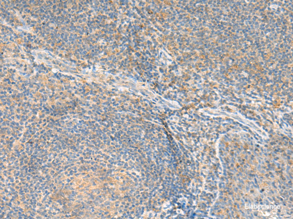 Immunohistochemistry of paraffin-embedded Human tonsil tissue  using RNF207 Polyclonal Antibody at dilution of 1:80(×200)