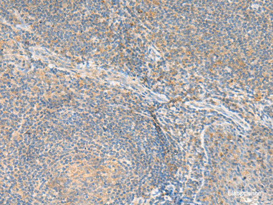 Immunohistochemistry of paraffin-embedded Human tonsil tissue  using RNF207 Polyclonal Antibody at dilution of 1:80(×200)