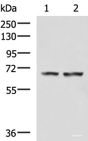 Western blot analysis of Human cerebella tissue Human cerebrum tissue lysates  using FNBP1L Polyclonal Antibody at dilution of 1:750