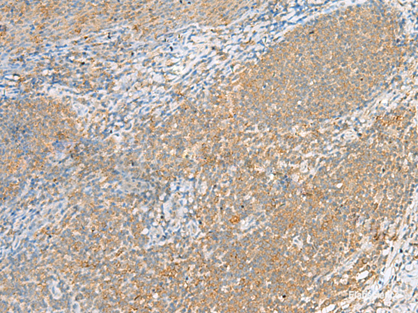 Immunohistochemistry of paraffin-embedded Human tonsil tissue  using FOLR1 Polyclonal Antibody at dilution of 1:80(×200)