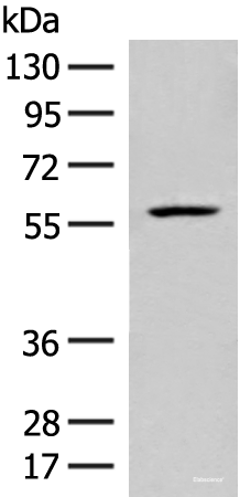 Western blot analysis of Mouse liver tissue lysate  using FKTN Polyclonal Antibody at dilution of 1:450