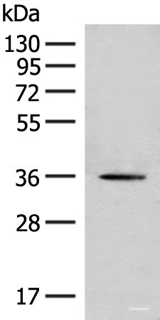 Western blot analysis of Hela cell lysate  using MLST8 Polyclonal Antibody at dilution of 1:500