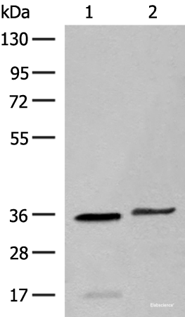 Western blot analysis of Human sigmoid tissue and HT-29 cell lysates  using LGALS4 Polyclonal Antibody at dilution of 1:400
