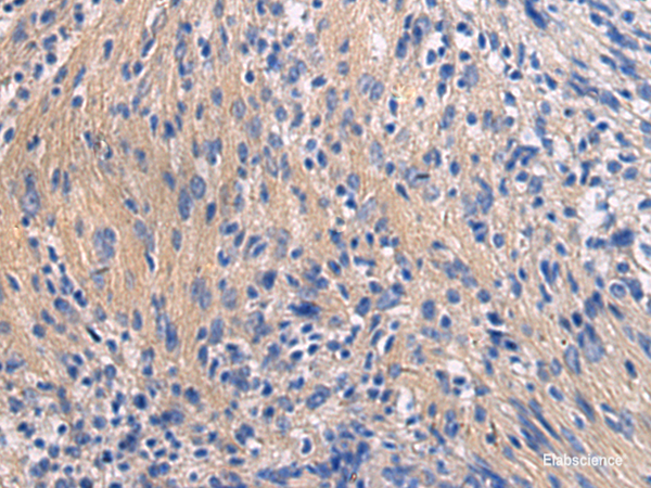 Immunohistochemistry of paraffin-embedded Human brain tissue  using GALR3 Polyclonal Antibody at dilution of 1:50(×200)