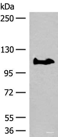 Western blot analysis of PC-3 cell lysate  using GARNL3 Polyclonal Antibody at dilution of 1:400
