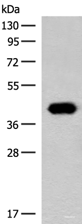 Western blot analysis of Hela cell lysate  using GIPC1 Polyclonal Antibody at dilution of 1:400