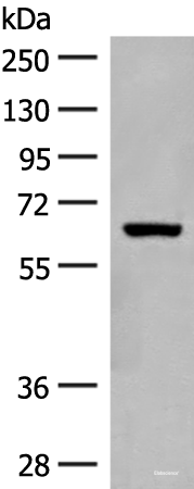 Western blot analysis of Mouse liver tissue lysate  using GLS2 Polyclonal Antibody at dilution of 1:400
