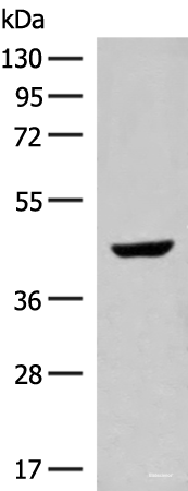Western blot analysis of Human fetal liver tissue lysate  using GNAT1 Polyclonal Antibody at dilution of 1:250