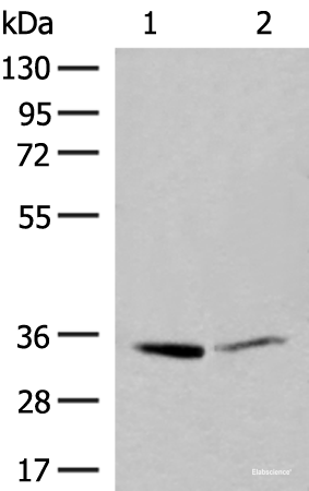 Western blot analysis of A375 and Hela cell lysates  using LDHA Polyclonal Antibody at dilution of 1:400