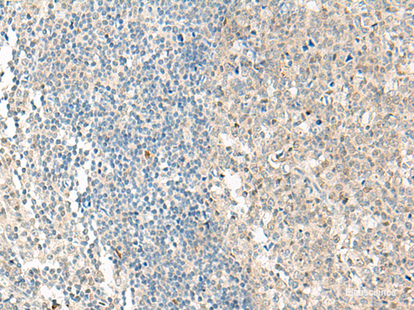 Immunohistochemistry of paraffin-embedded Human tonsil tissue  using NPBWR1 Polyclonal Antibody at dilution of 1:50(×200)