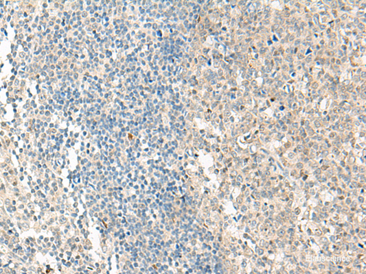 Immunohistochemistry of paraffin-embedded Human tonsil tissue  using NPBWR1 Polyclonal Antibody at dilution of 1:50(×200)
