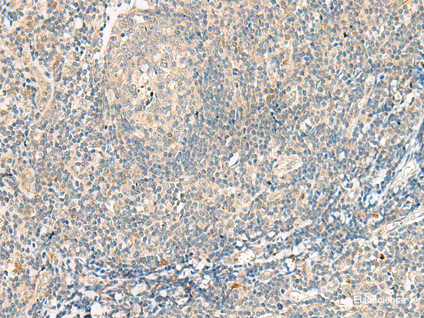 Immunohistochemistry of paraffin-embedded Human tonsil tissue  using GPR75 Polyclonal Antibody at dilution of 1:95(×200)