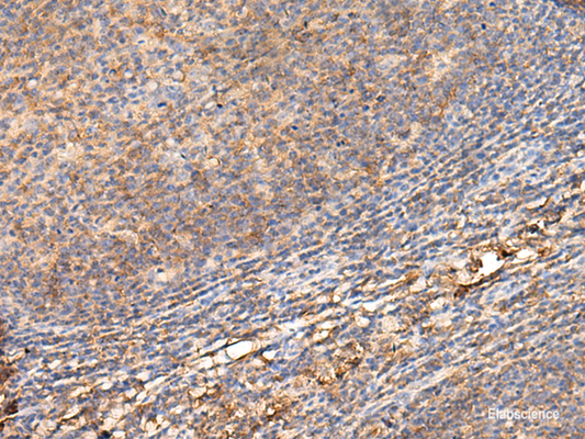 Immunohistochemistry of paraffin-embedded Human tonsil tissue  using ADGRA1 Polyclonal Antibody at dilution of 1:70(×200)