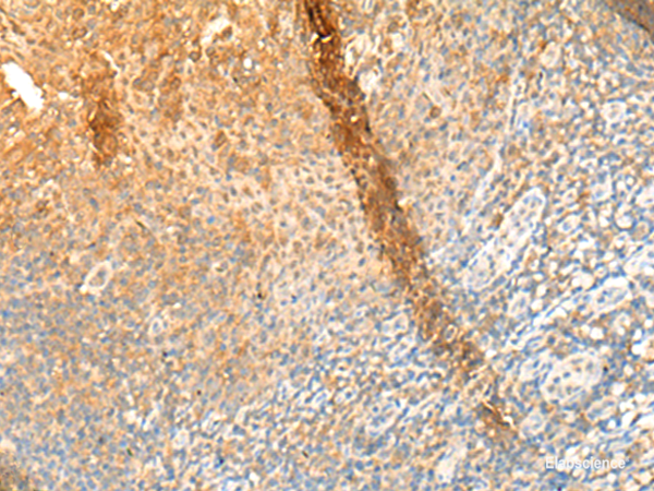 Immunohistochemistry of paraffin-embedded Human tonsil tissue  using GPR162 Polyclonal Antibody at dilution of 1:65(×200)