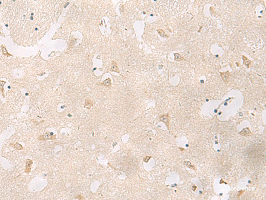 Immunohistochemistry of paraffin-embedded Human brain tissue  using GPR83 Polyclonal Antibody at dilution of 1:60(×200)