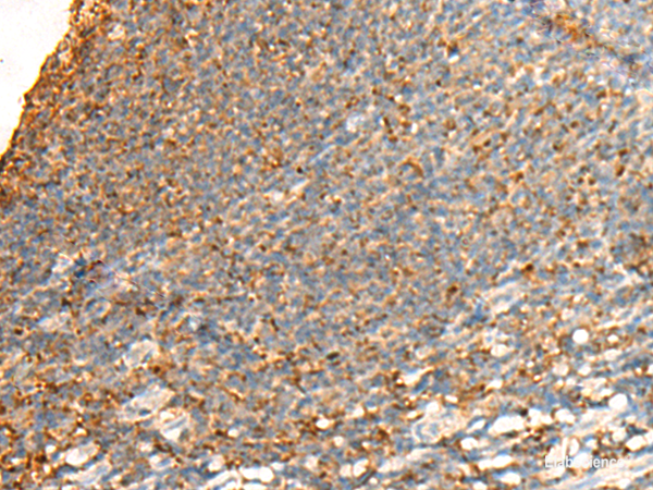 Immunohistochemistry of paraffin-embedded Human tonsil tissue  using GPSM2 Polyclonal Antibody at dilution of 1:65(×200)