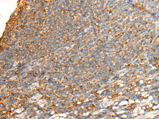 Immunohistochemistry of paraffin-embedded Human tonsil tissue  using GPSM2 Polyclonal Antibody at dilution of 1:65(×200)