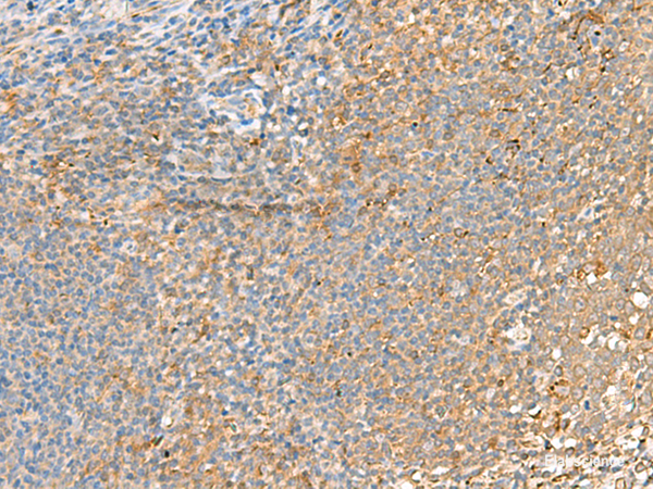 Immunohistochemistry of paraffin-embedded Human tonsil tissue  using GRIK2 Polyclonal Antibody at dilution of 1:55(×200)