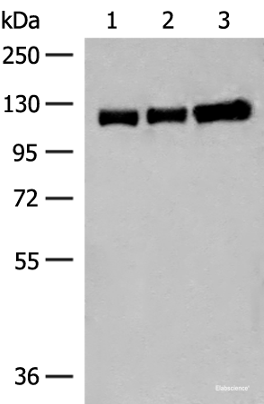 Western blot analysis of Human cerebella tissue Human cerebrum tissue and Human fetal brain tissue lysates  using GRIK3 Polyclonal Antibody at dilution of 1:400