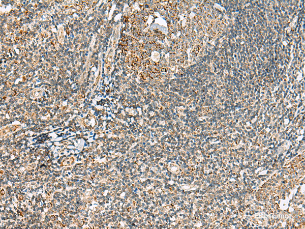 Immunohistochemistry of paraffin-embedded Human tonsil tissue  using MOB2 Polyclonal Antibody at dilution of 1:40(×200)