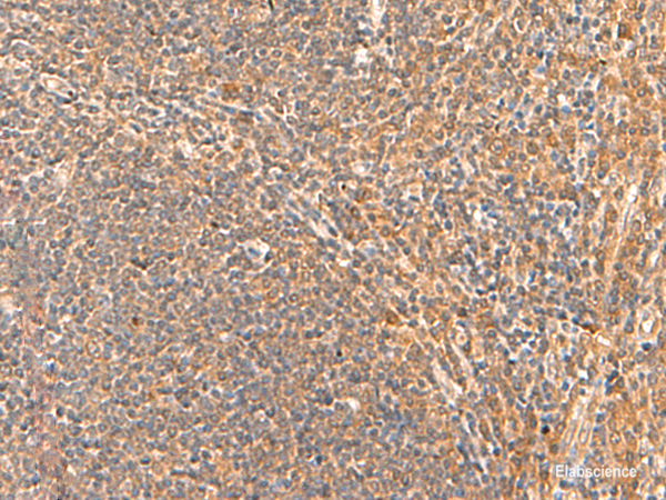 Immunohistochemistry of paraffin-embedded Human tonsil tissue  using HPCA Polyclonal Antibody at dilution of 1:55(×200)