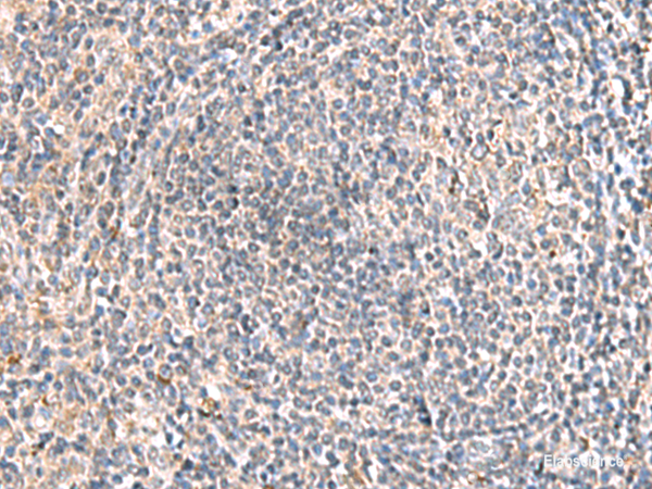 Immunohistochemistry of paraffin-embedded Human tonsil tissue  using HLA-DOB Polyclonal Antibody at dilution of 1:45(×200)