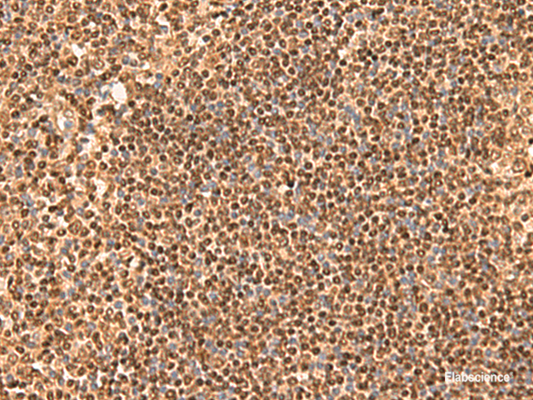Immunohistochemistry of paraffin-embedded Human tonsil tissue  using SIX6 Polyclonal Antibody at dilution of 1:50(×200)