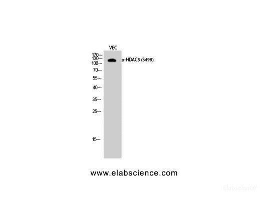 Western Blot analysis of VEC cells with Phospho-HDAC5 (Ser498) Polyclonal Antibody at dilution of 1:500