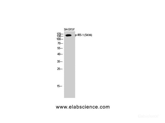 Western Blot analysis of SH-SY5Y cells using Phospho-IRS1 (Ser636) Polyclonal Antibody at dilution of 1:2000