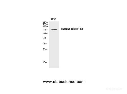 Western Blot analysis of 293T cells using Phospho-MAP3K7 (Thr187) Polyclonal Antibody at dilution of 1:1000