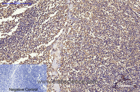 Immunohistochemistry of paraffin-embedded Human tonsil tissue using CD68 Monoclonal Antibody at dilution of 1:200.