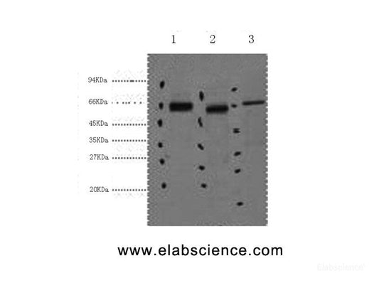 Western Blot analysis of 1) Hela, 2) Mouse kidney, 3) Mouse brain using CK-7 Monoclonal Antibody at dilution of 1:2000.
