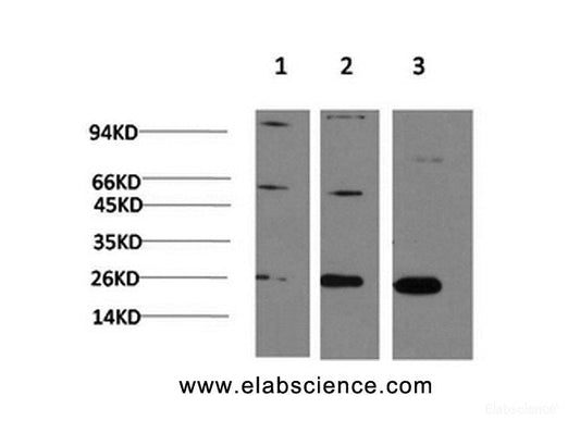 Western Blot analysis of 1) Hela, 2)3T3, 3) PC-12 cells using CBX3 Monoclonal Antibody at dilution of 1:1000.