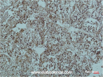Immunohistochemistry of paraffin-embedded Human Liver tissue using Smad3 Monoclonal Antibody at dilution of 1:200.