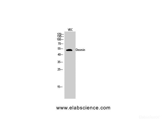 Western Blot analysis of VEC cells using Desmin Polyclonal Antibody at dilution of 1:2000.