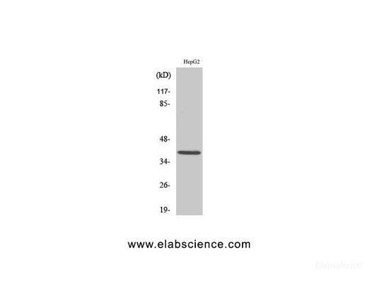Western Blot analysis of Jurkat cells using MCL1 Polyclonal Antibody at dilution of 1:1000.