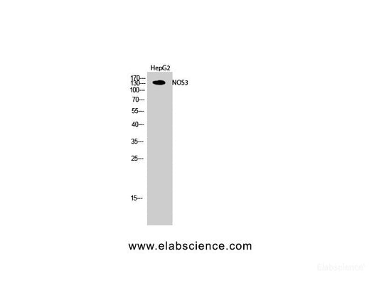 Western Blot analysis of HepG2 cells with NOS3 Polyclonal Antibody.