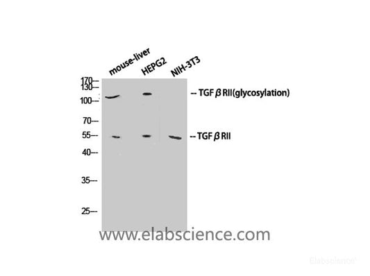 Western Blot analysis of various cells using TGF β Receptor II Polyclonal Antibody at dilution of 1:1000.