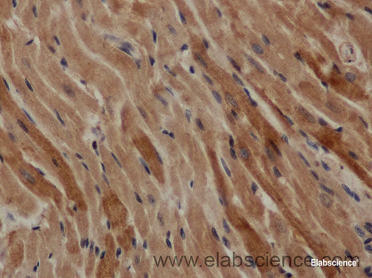 Immunohistochemistry of paraffin-embedded Mouse heart using TGFB1 Polyclonal Antibody at dilution of 1:50