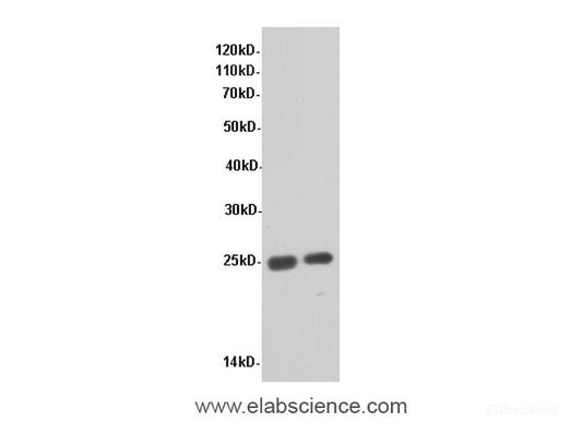 Western Blot analysis of Rat liver and Rat kidney tissue using CRP Polyclonal Antibody at dilution of 1:600