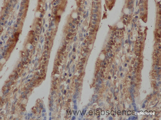 Immunohistochemistry of paraffin-embedded Rat ileum using FABP2 Polyclonal Antibody at dilution of 1:50