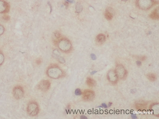 Immunohistochemistry of paraffin-embedded Rat brain using ACSBG1 Polyclonal Antibody at dilution of 1:50
